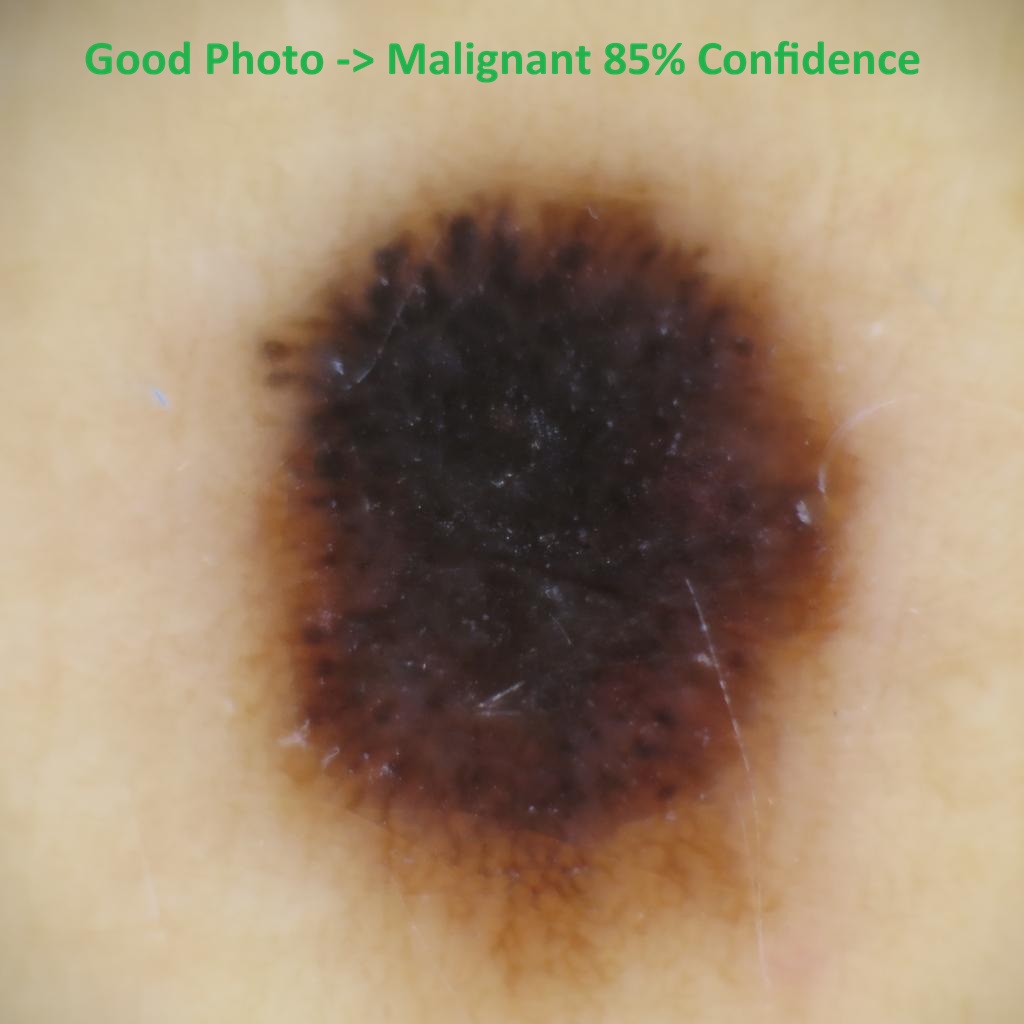 Good mole photo example